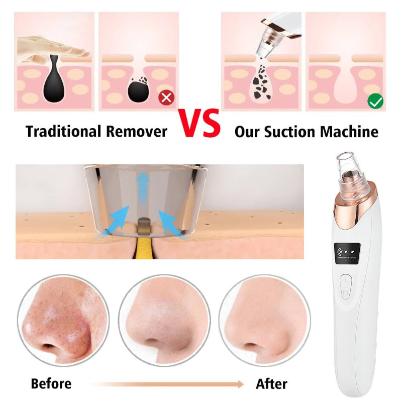 Electric Vacuum Suction Blackhead Remover Facial Pore Cleaner Comedone Spot Acne Pimple Blackhead Extractor USB Rechargeable