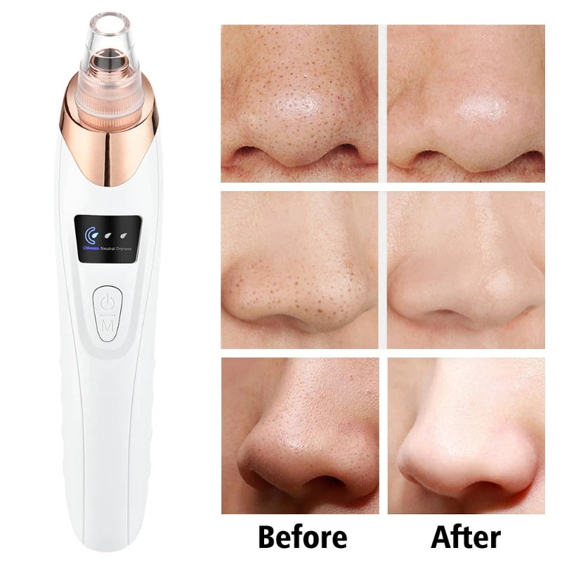 Electric Vacuum Suction Blackhead Remover Facial Pore Cleaner Comedone Spot Acne Pimple Blackhead Extractor USB Rechargeable